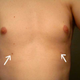 Image for article titled Woman Grows Full Size Nipple On Foot